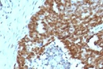 Anti-Nucleolin Antibody