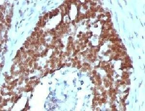 Anti-Nucleolin Antibody