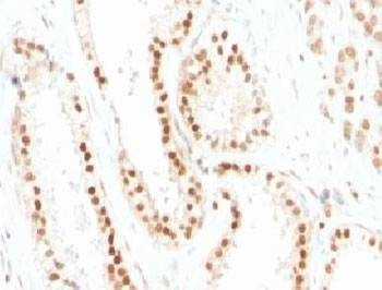 Anti-p27Kip1 Antibody