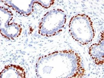 Anti-p40 Antibody