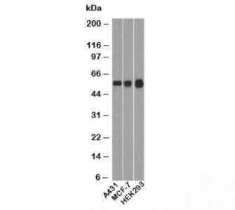Anti-p53 Antibody N-terminus