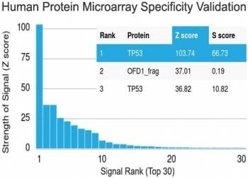 Anti-p53 / TP53 (N-Terminal Region) Antibody