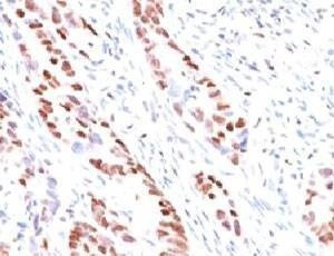 Anti-p57 Antibody