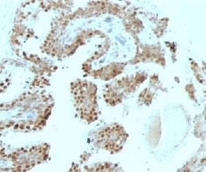 Anti-p57Kip2 Antibody