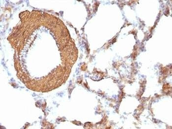 Anti-pan Muscle Actin Antibody Cocktail