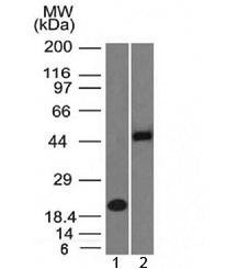 Anti-PAX8 Antibody