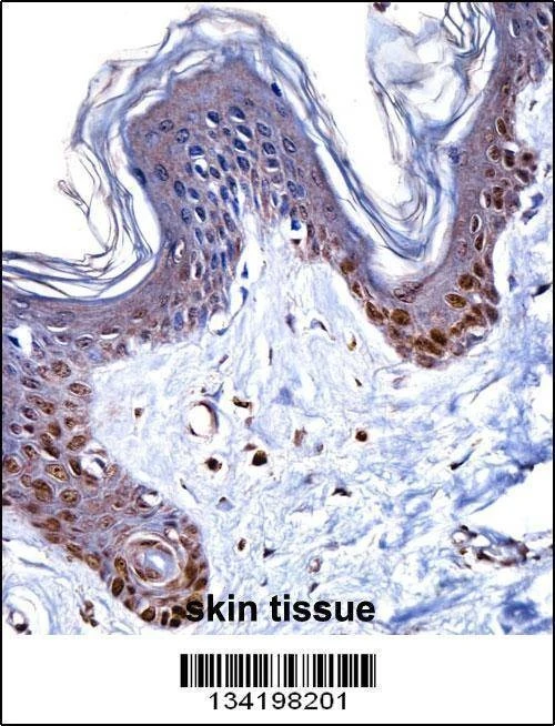 Anti-HMGN1 (N-term) Antibody