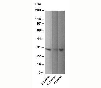 Anti-PGP9.5 Antibody UchL1