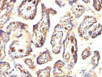 Anti-Podocalyxin Antibody