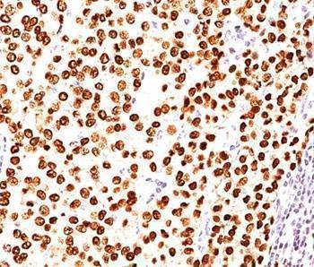 Anti-Progesterone Receptor Antibody