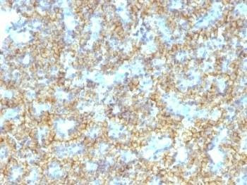 Anti-PTH Antibody