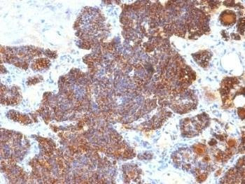 Anti-PTH Antibody