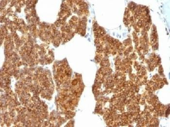 Anti-Parathyroid Hormone Antibody (N-Terminal)