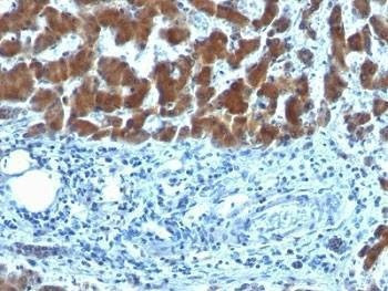 Anti-RBP Antibody