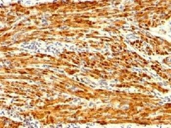 Anti-Calponin Antibody