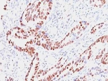 Anti-Retinoblastoma / Rb Antibody