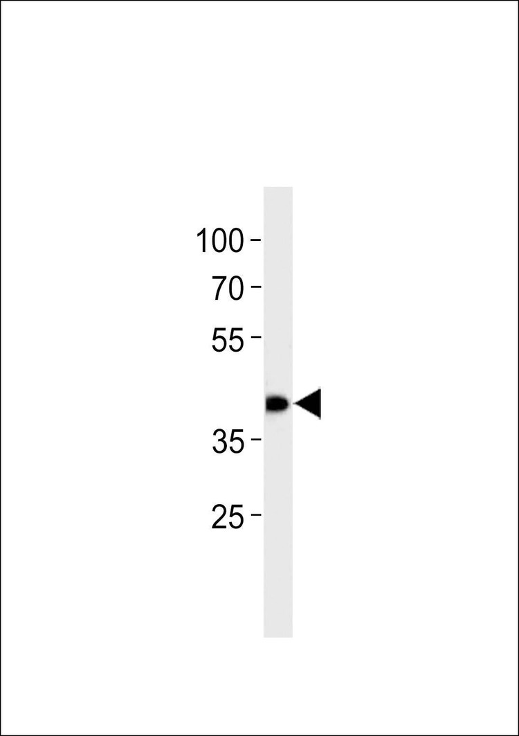 Anti-HDBP1 (Center) Antibody