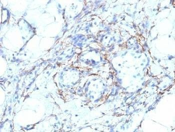 Anti-SMMHC Antibody Cocktail