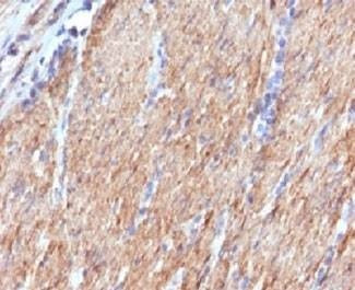 Anti-SMMHC Antibody