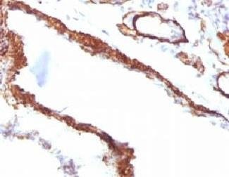 Anti-Smooth Muscle Actin Antibody