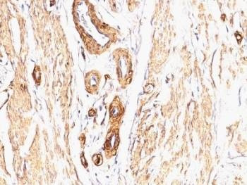 Anti-Smooth Muscle Actin Antibody