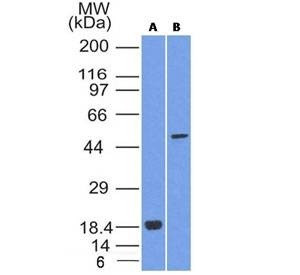 Anti-SOX10 Antibody
