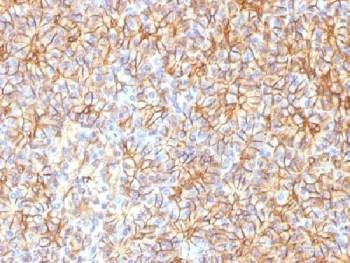 Anti-SPTBN2 / Spectrin beta III Antibody