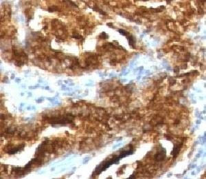 Anti-TAG-72 Antibody