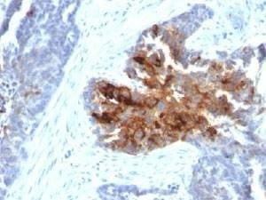 Anti-TAG-72 Antibody Cocktail