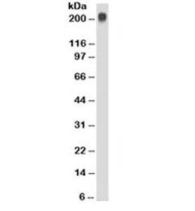 Anti-TAG-72 Antibody
