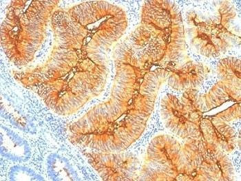 Anti-TAG-72 Antibody