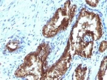 Anti-TDP2 / ETS1 associated protein II Antibody