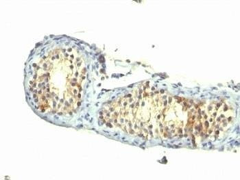 Anti-TGF alpha Antibody
