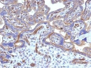 Anti-Thrombomodulin / CD141 Antibody