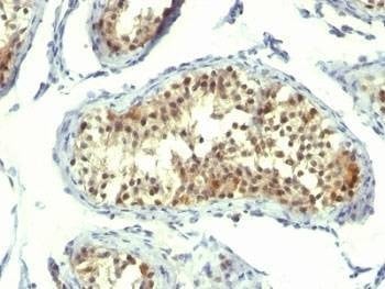 Anti-Thymidylate Synthase Antibody