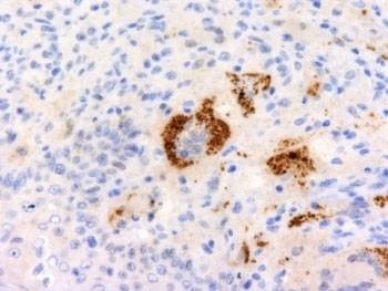 Anti-TNF-a Antibody
