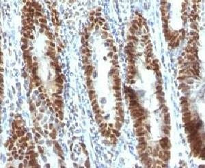 Anti-TOX3 Antibody