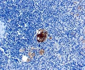 Anti-TRAcP Antibody