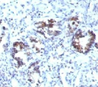 Anti-Transgelin Antibody