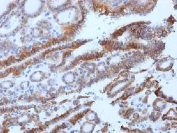 Anti-TSHR Antibody (beta chain)