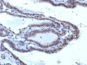 Anti-TSHR Antibody (alpha chain)