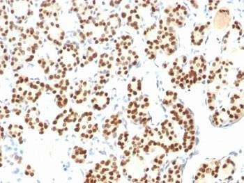 Anti-TTF1 Antibody Cocktail