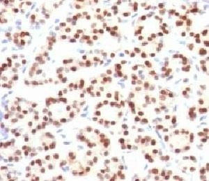 Anti-TTF1 Antibody