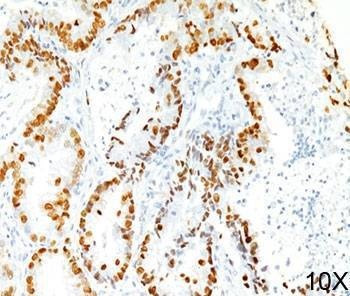 Anti-TTF-1 Antibody
