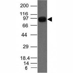Anti-UACA Antibody