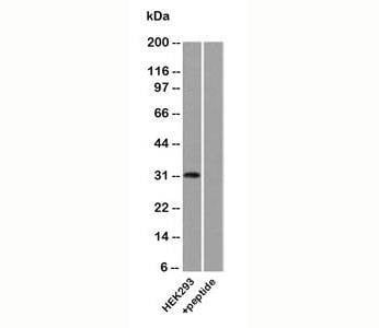 Anti-Uroplakin 3A Antibody