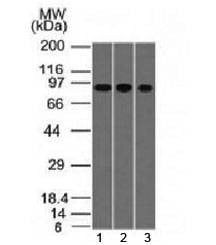Anti-Villin Antibody