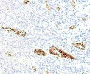 Anti-von Willebrand Factor Antibody