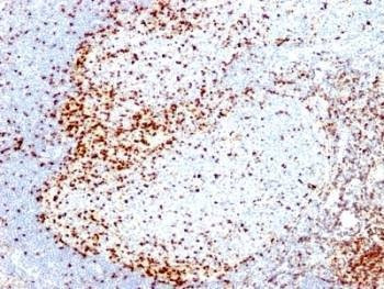 Anti-ZAP70 Antibody