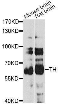 Anti-TH Antibody